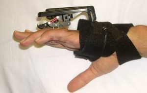 Digit Widget - to aid in the treatment of PIP flexion contractures